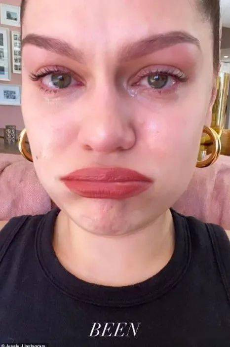 结石姐更新病情没有一天不痛