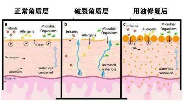 什么|肌肤油我不油天，火爆全网的“以油养肤”究竟是什么？