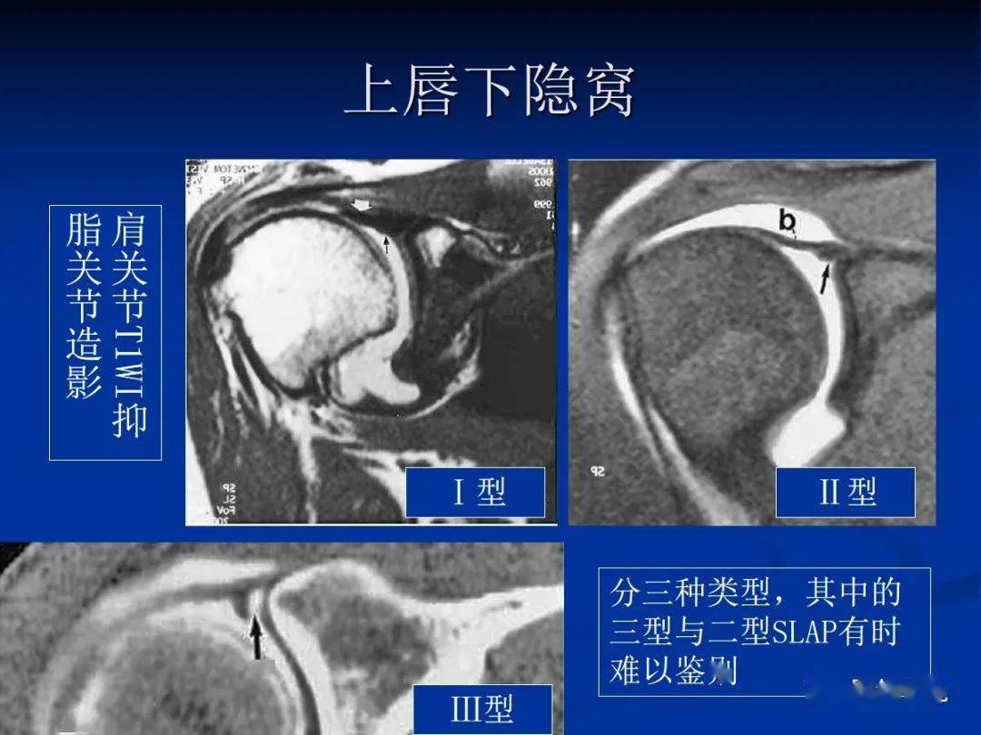 異常x線表現【經典】磁共振的臨床應用——脊柱篇【收藏】胸部影像