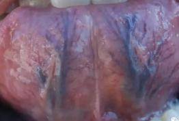 食欲|食欲差、没精神、出汗头晕心慌慌，秋高气爽为何我的“苦夏”挥之不去？