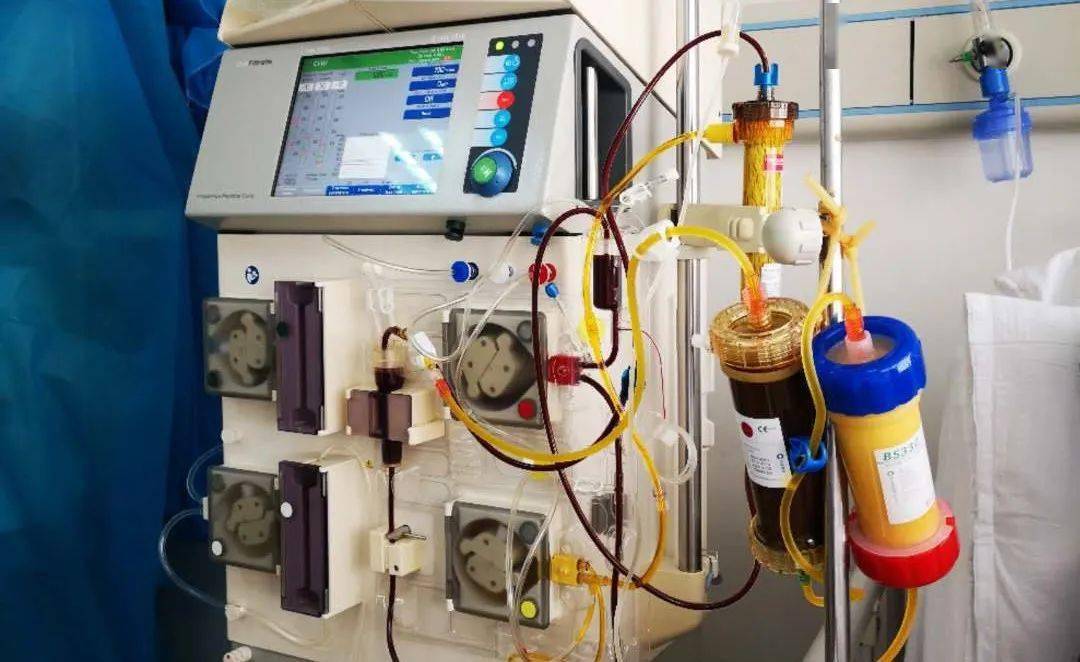 双重血浆分子吸附操作流程和实战交流