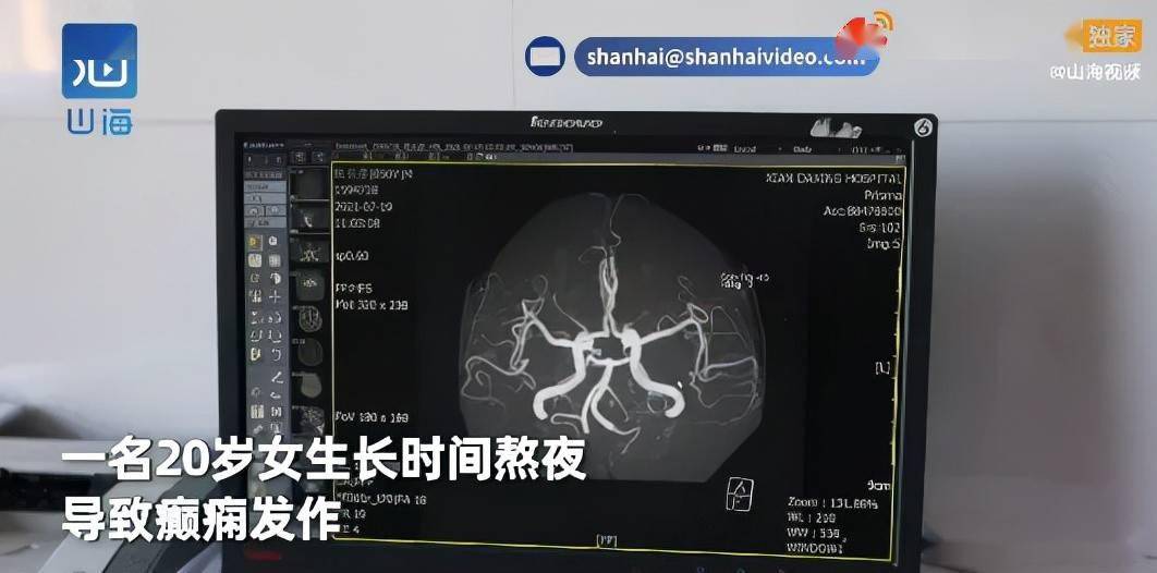 年轻人|20岁女孩突然倒地抽搐！医生：这种病一半是年轻人