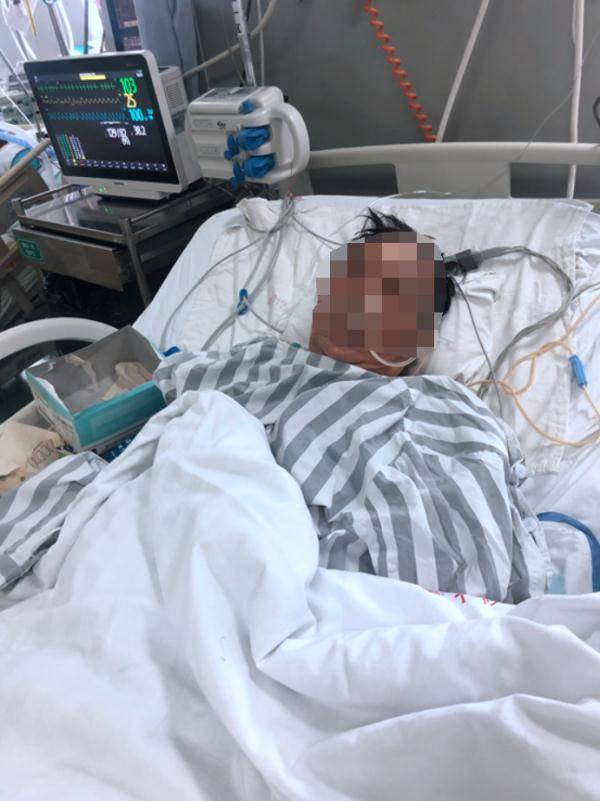 罪魁祸首|可怕！广西老伯手掌皮肤破裂，致手臂截肢！罪魁祸首是…