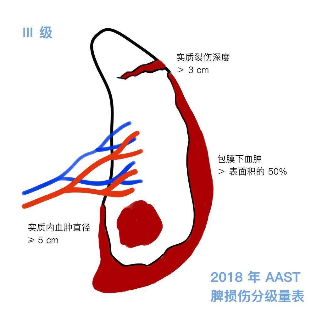 脾什么什么切成语_成语故事简笔画(3)