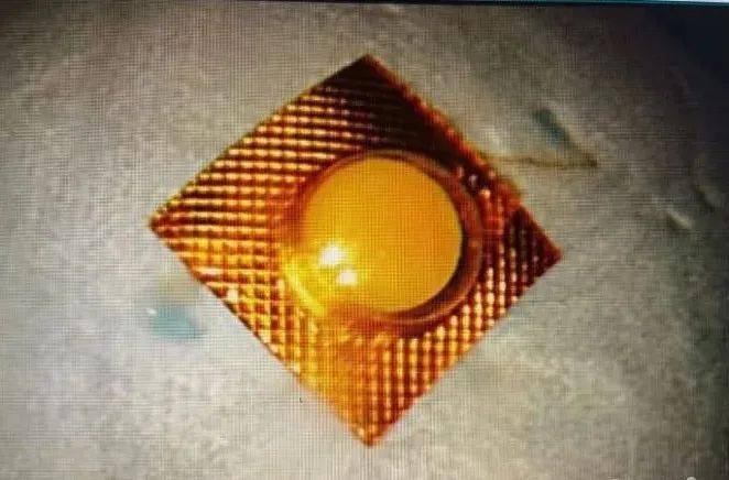 xkb_|男子接电话做了一个动作，服下的救命药竟成了“定时炸弹”