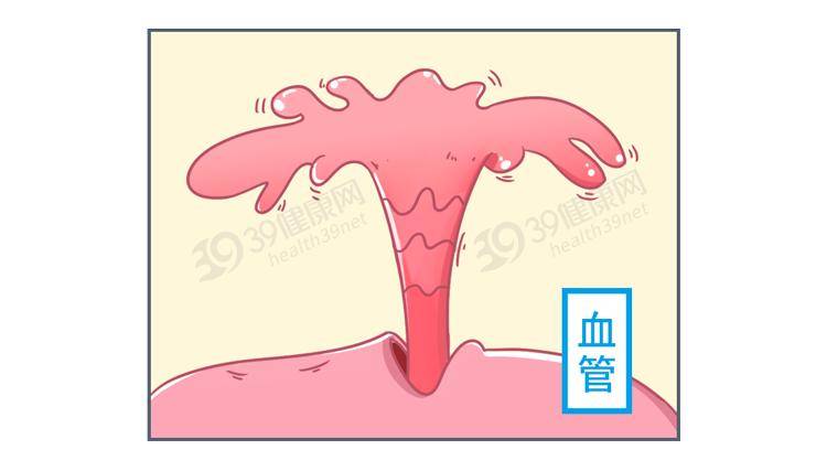 以下途径|好好的脑膜为什么就发炎了？