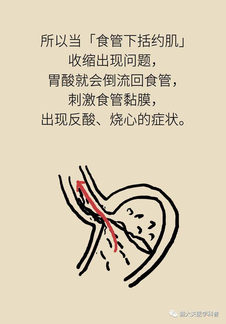 烧心|烧心烧得难受？6个方法可缓解