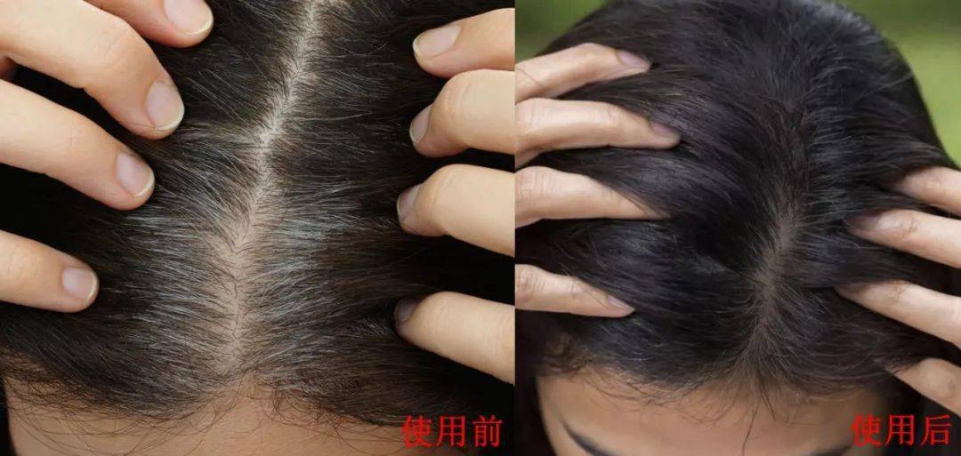 汪女士|白发越长越多？原来是这里出了毛病！坚持一招，养一头乌黑墨发！