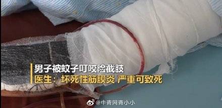 皮肤|男子被蚊子叮咬后发高烧险截肢 医生：严重可致死