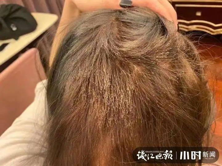 头发女生花1000元染发成了这副模样：赔我20万！店长懵了