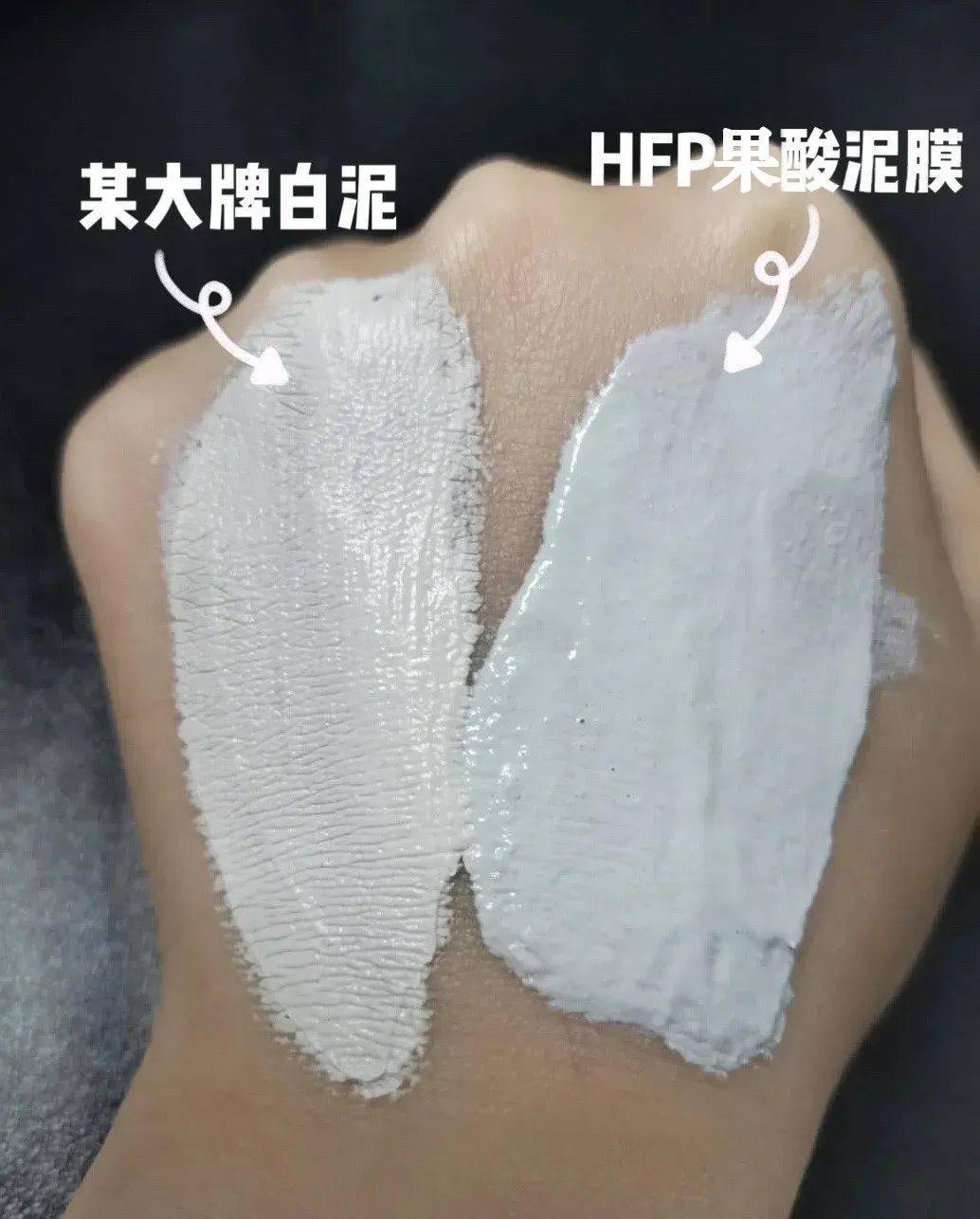 黑头洗完脸别擦水乳！漏掉这一步，难怪你黑头粉刺越来越多！