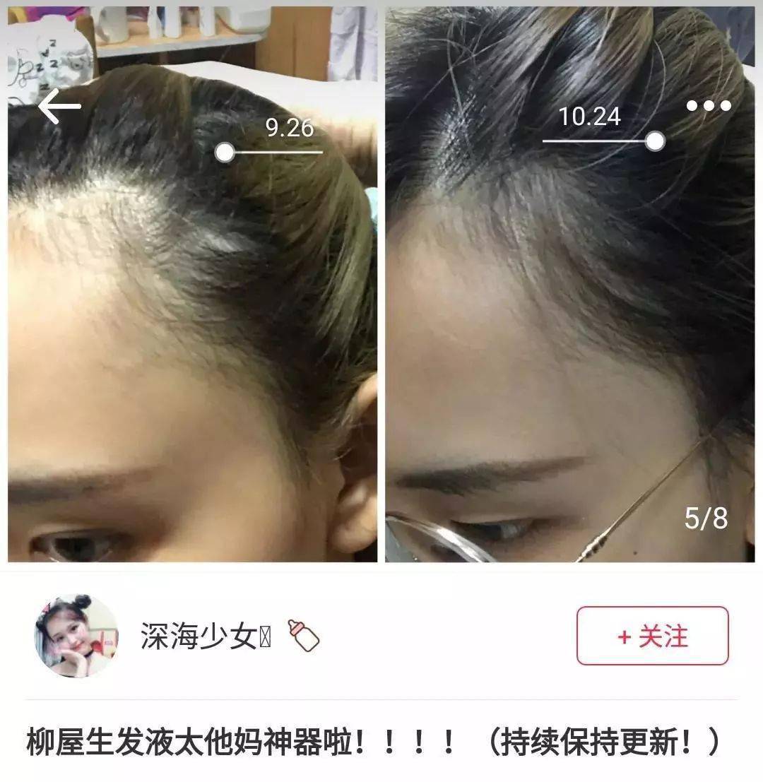 发型为了拯救发际线，日本人可是绞尽脑汁！