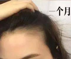 发型为了拯救发际线，日本人可是绞尽脑汁！