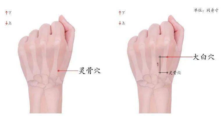 坐骨神经痛手部按摩图片