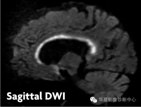 畸形|這 6 種典型影像征象的病變你都認識了嗎