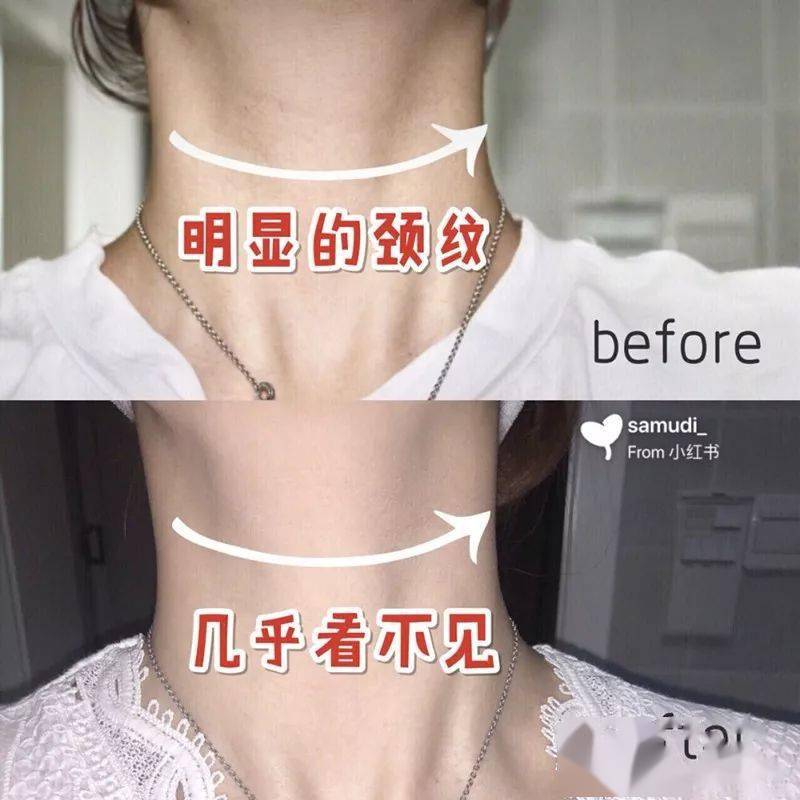 熨斗神仙价！99元抢欧莱雅紫熨斗眼霜“正装”！4 周淡化眼纹，巨强修护力，全脸都能用！