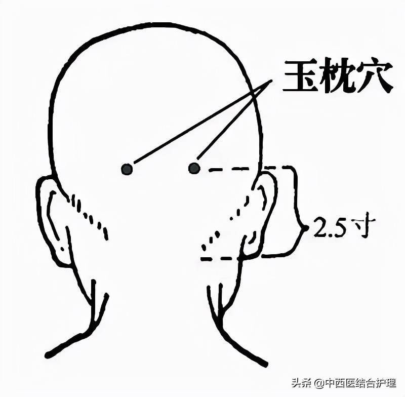 枕髁的准确位置图图片