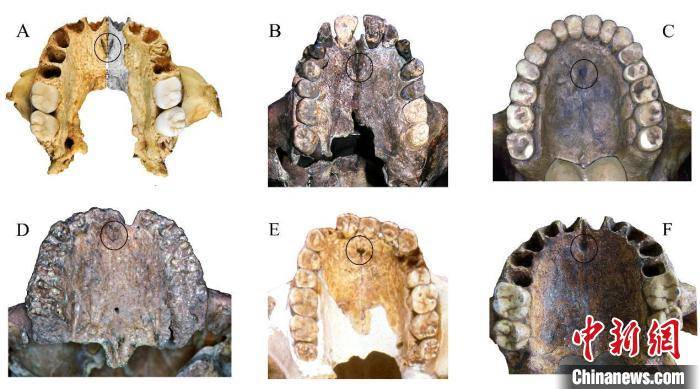 特征|30万年前古人类长什么样子？科学家最新复原华龙洞人容貌