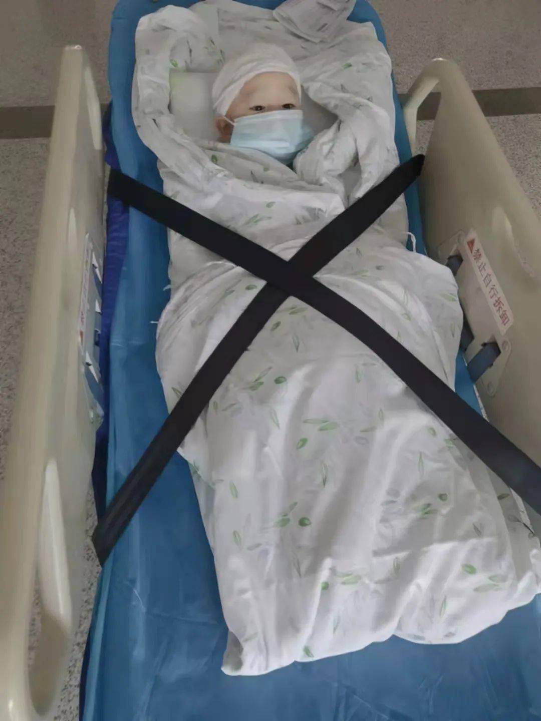 青县两岁孩子头部恶性肿瘤一周做了两次开颅手术