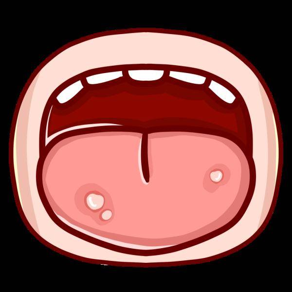 男子|杭州男子老是口腔溃疡 医生让他做胃镜检查 结果大吃一惊