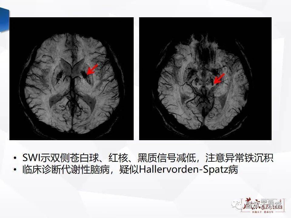 盛放云课堂 美编 | 石 喻 审核 | 祁 英 精彩推荐: 全网最全的解剖