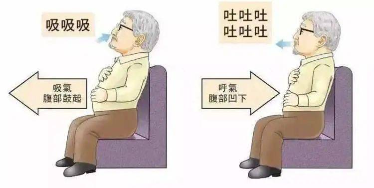 氣流|喘不上氣、咳嗽……松江醫師與你聊聊，換季時，“老慢支”該怎么辦