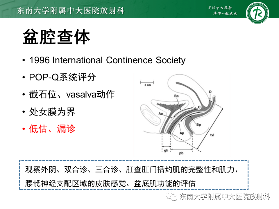 盆腔臟器脫垂mri影像