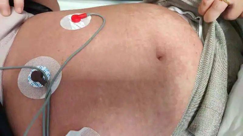 病例|慎买！女子自行买药治痛风，全身皮疹险丧命