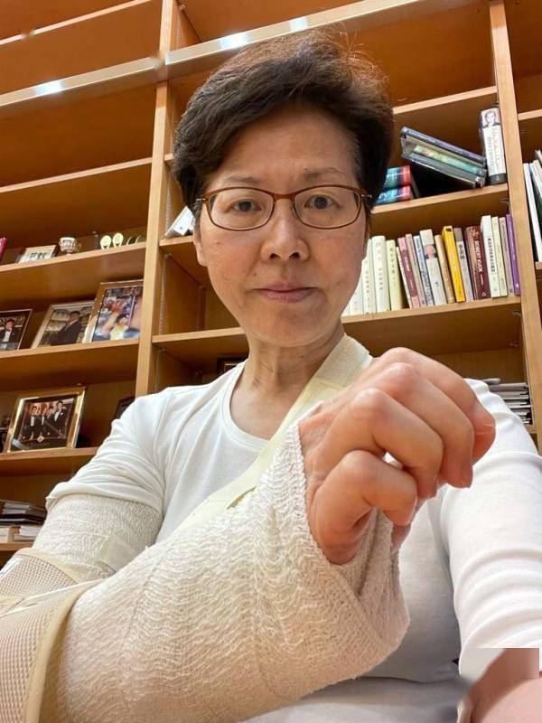 林郑月娥发文谈伤情 右手肘骨折打石膏固定 已出院 礼宾府