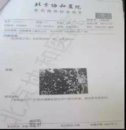 行走|【医文医话】罕见病例 | 低磷骨软化症确诊治疗始末