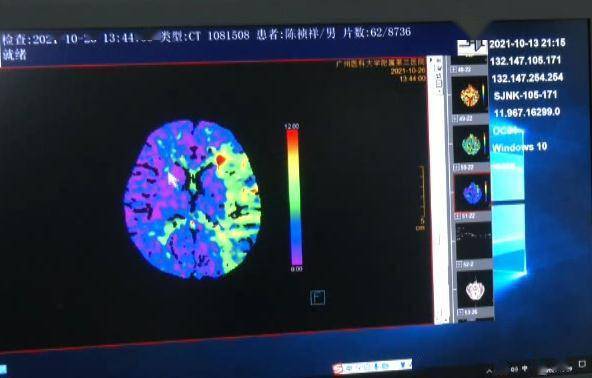 同事|18岁小伙一觉醒来脑中风，这个诱因很多人都会有