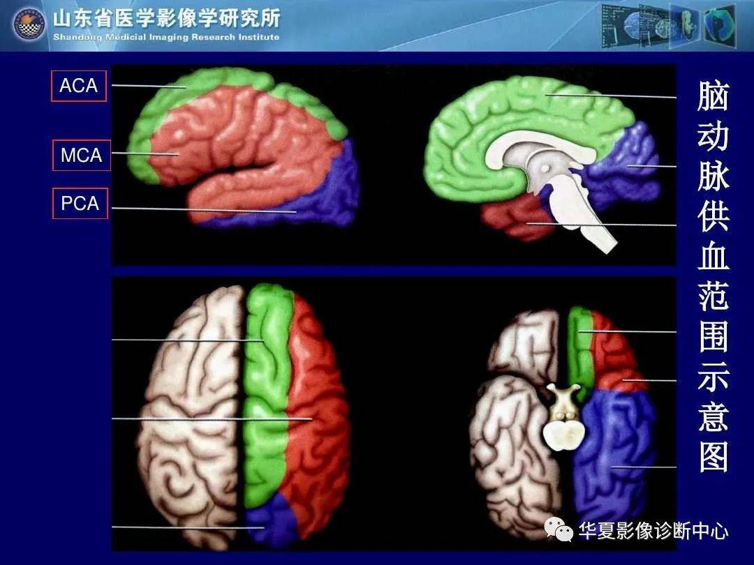 诊断|缺血性脑血管病的影像诊断