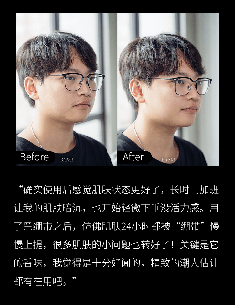 绷带黑绷带YYDS
