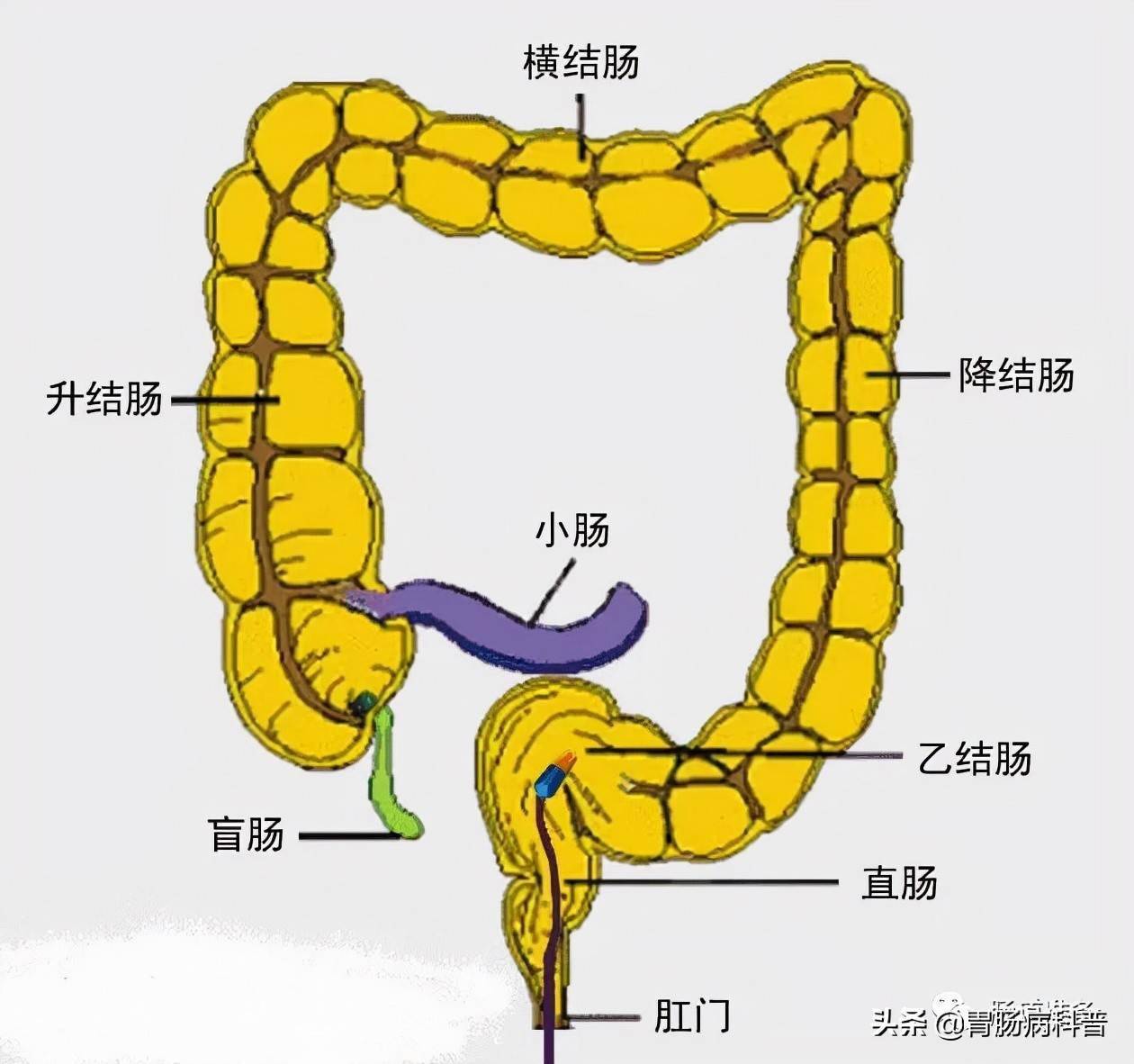 普通肠镜与无痛肠镜做哪个更合适