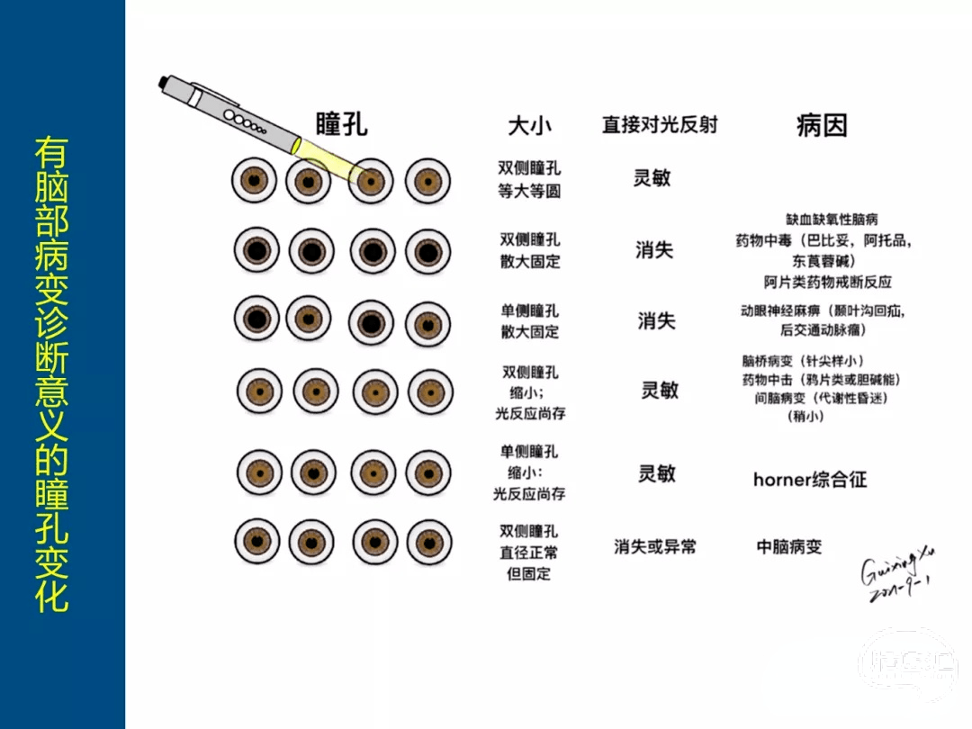 危重症患者的神經系統檢查(手繪)_反射