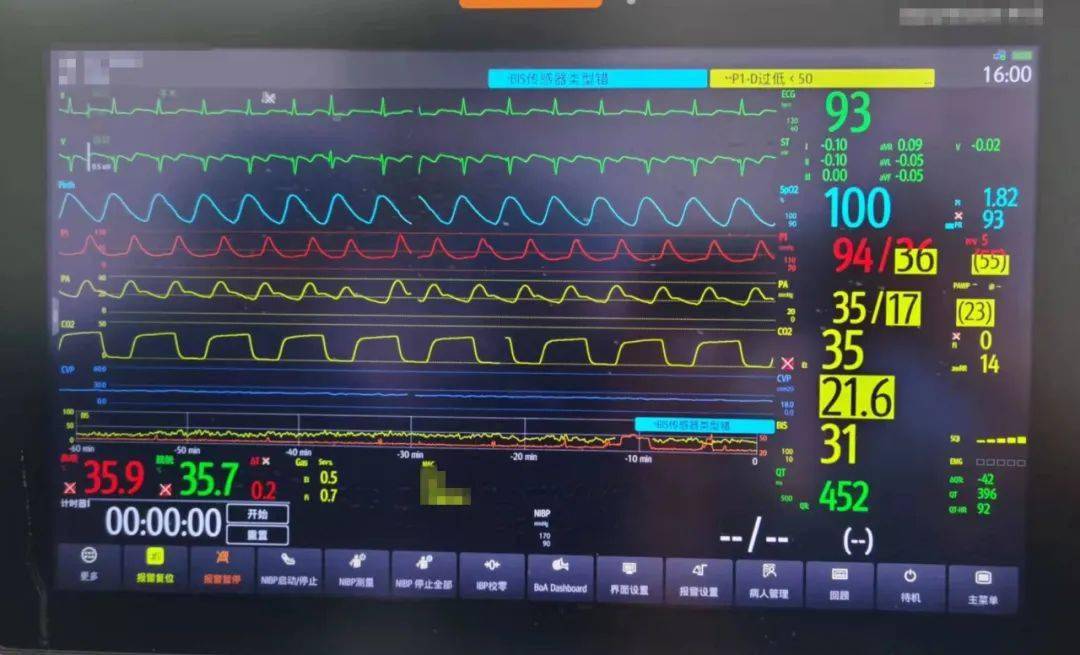 河西|南京市第一医院顺利完成第125例心脏移植手术（河西院区首例）！