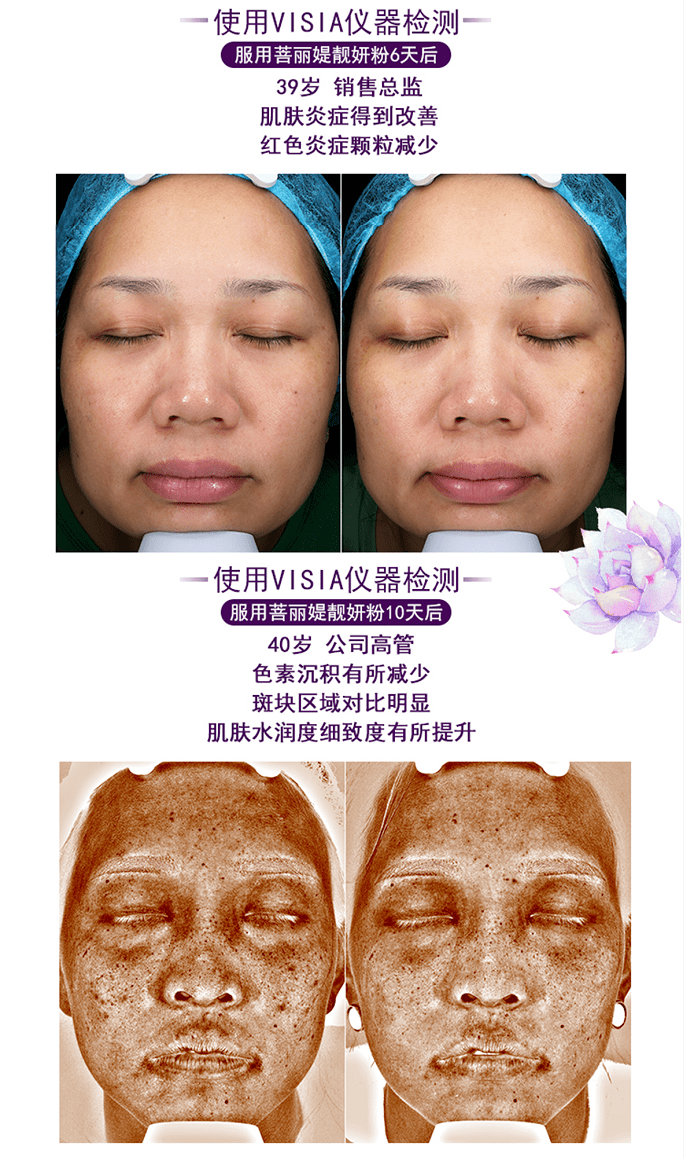余甘拍1发10：美白饮清货最后几十组！
