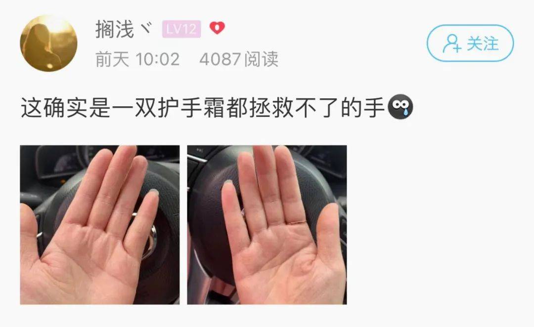 网友姑娘这双手，护手霜都拯救不了！网友：一看就知道是做什么的