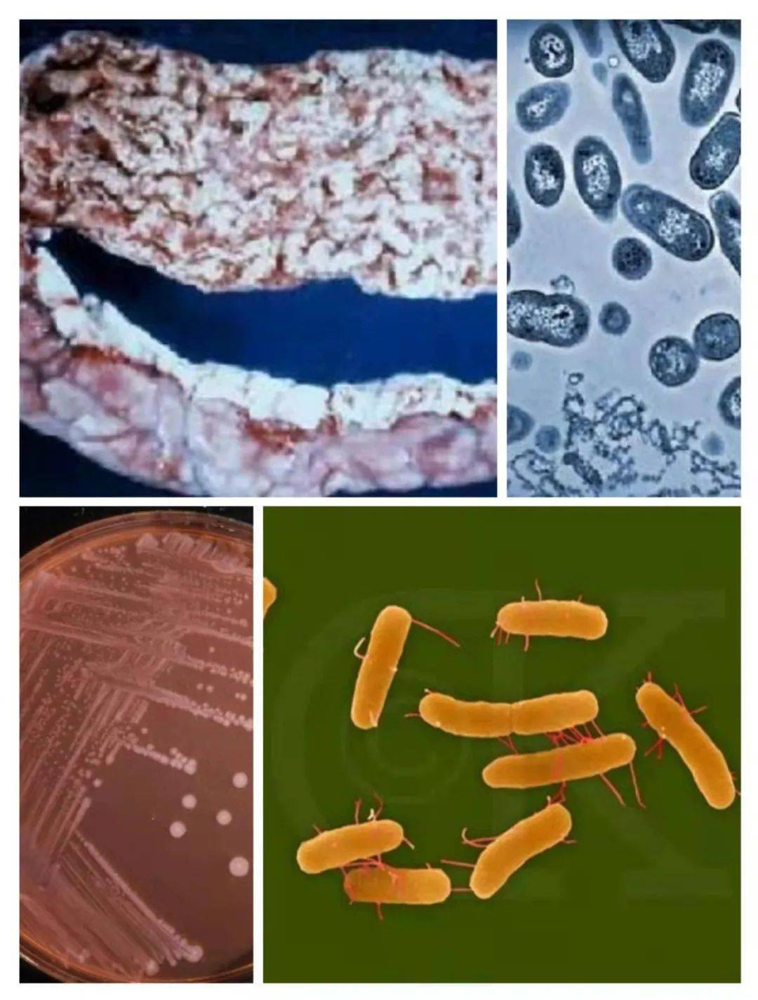 "兽医"匪浅||肠杆菌科--沙门氏菌