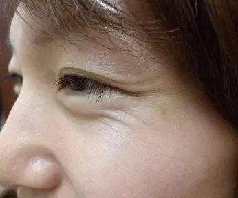 莱雅|理智的成分党都在用什么眼霜抗初老？