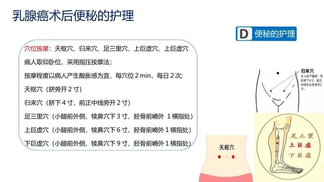 质量|【周四讲堂】乳腺癌术后便秘的护理