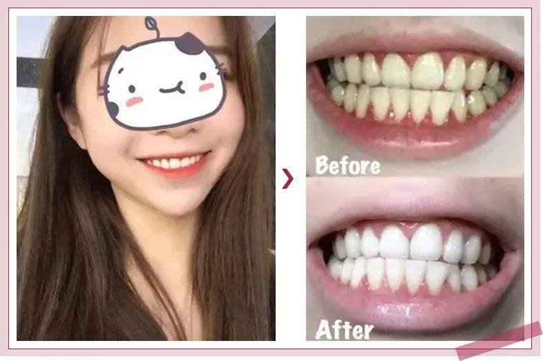 效果|又到火锅季，担心上火？降火神器了解一下