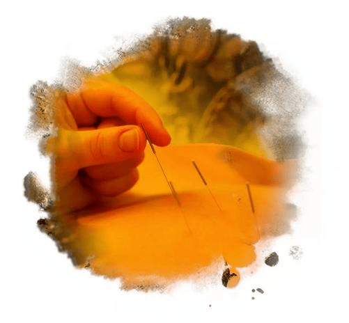 技术|【义诊通知】医院11月22日举办“世界针灸日”义诊活动