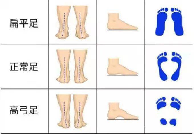 义诊通告千里之行始于足下关爱儿童从足筛查做起