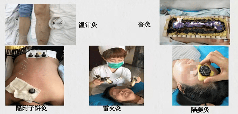 技术|【义诊通知】医院11月22日举办“世界针灸日”义诊活动