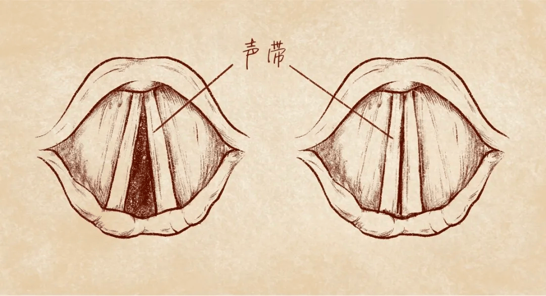 声带 卡通图片图片