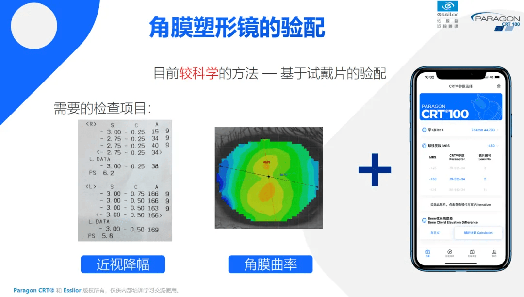 crt角膜塑形镜排名图片