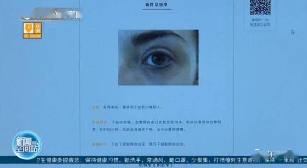 胡亮|南京一医院开设黑眼圈门诊！网友沸腾了：马上去挂号！