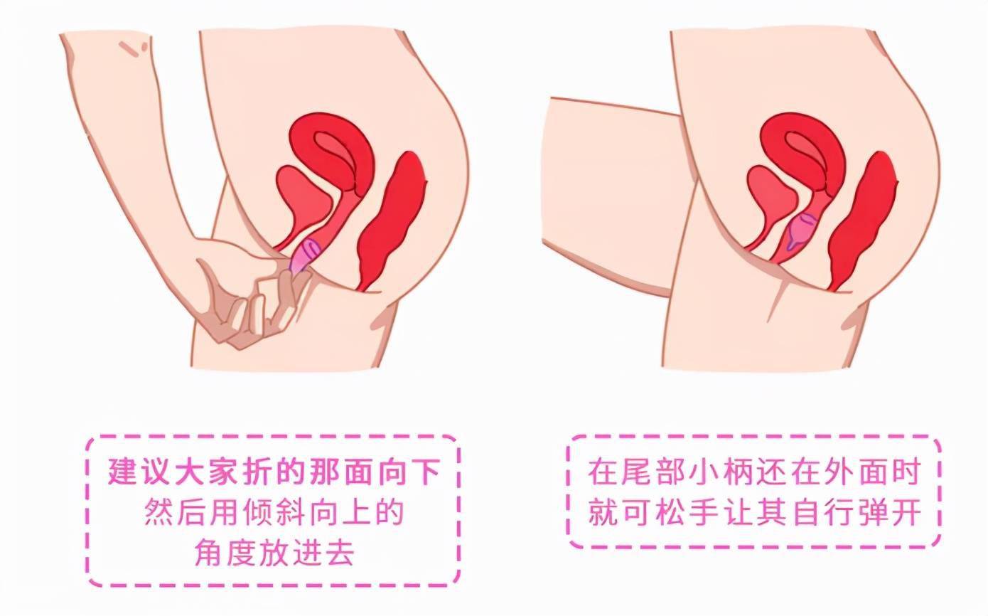 月經杯游泳蹦迪都不會漏如何把它放進體內手把手教你