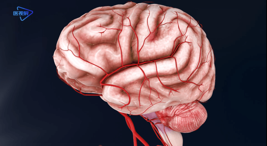 大脑动脉血管三维图图片